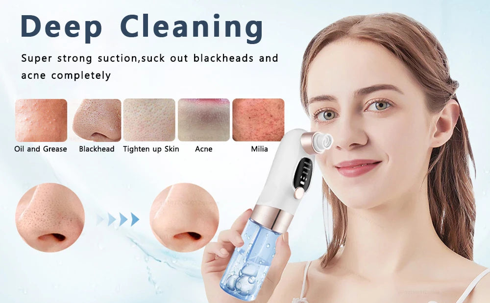 Blackhead Remover Pore Vacuum Face Cleaner