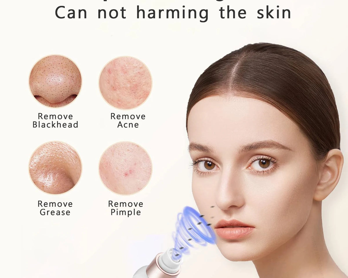 Blackhead Remover Pore Vacuum Face Cleaner