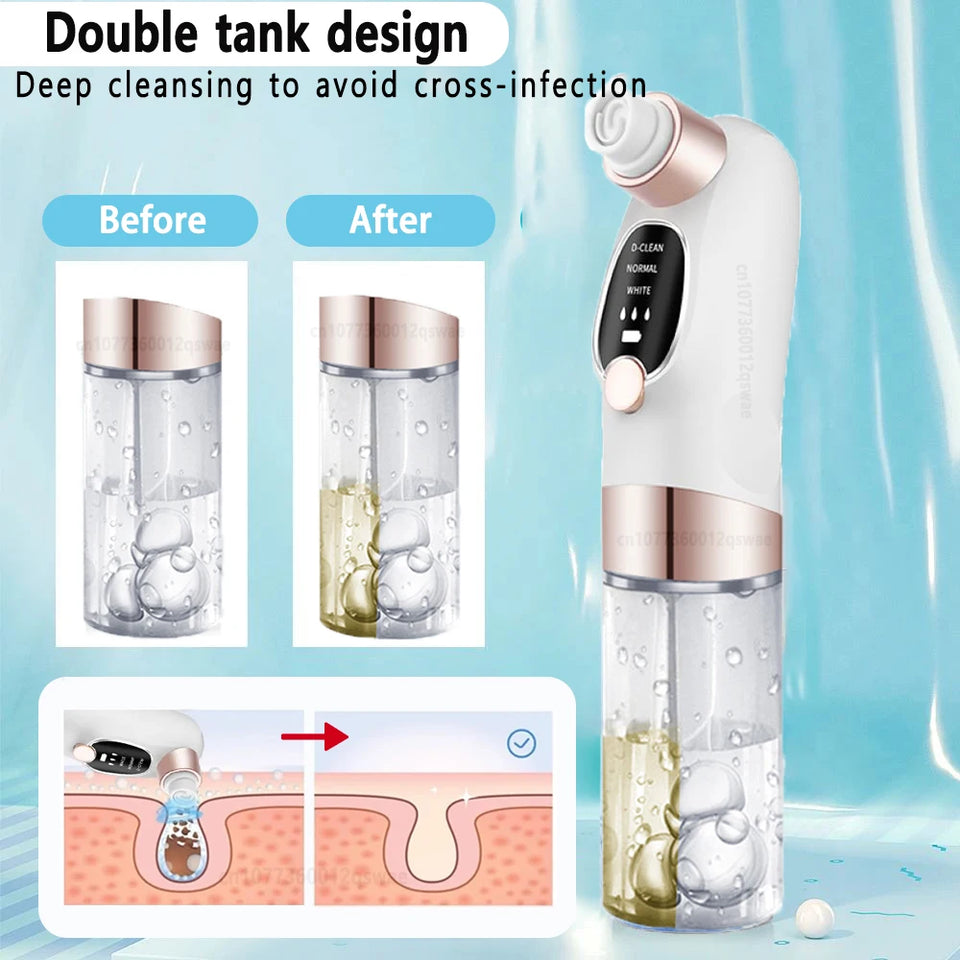 Blackhead Remover Pore Vacuum Face Cleaner