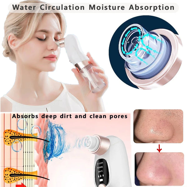 Blackhead Remover Pore Vacuum Face Cleaner