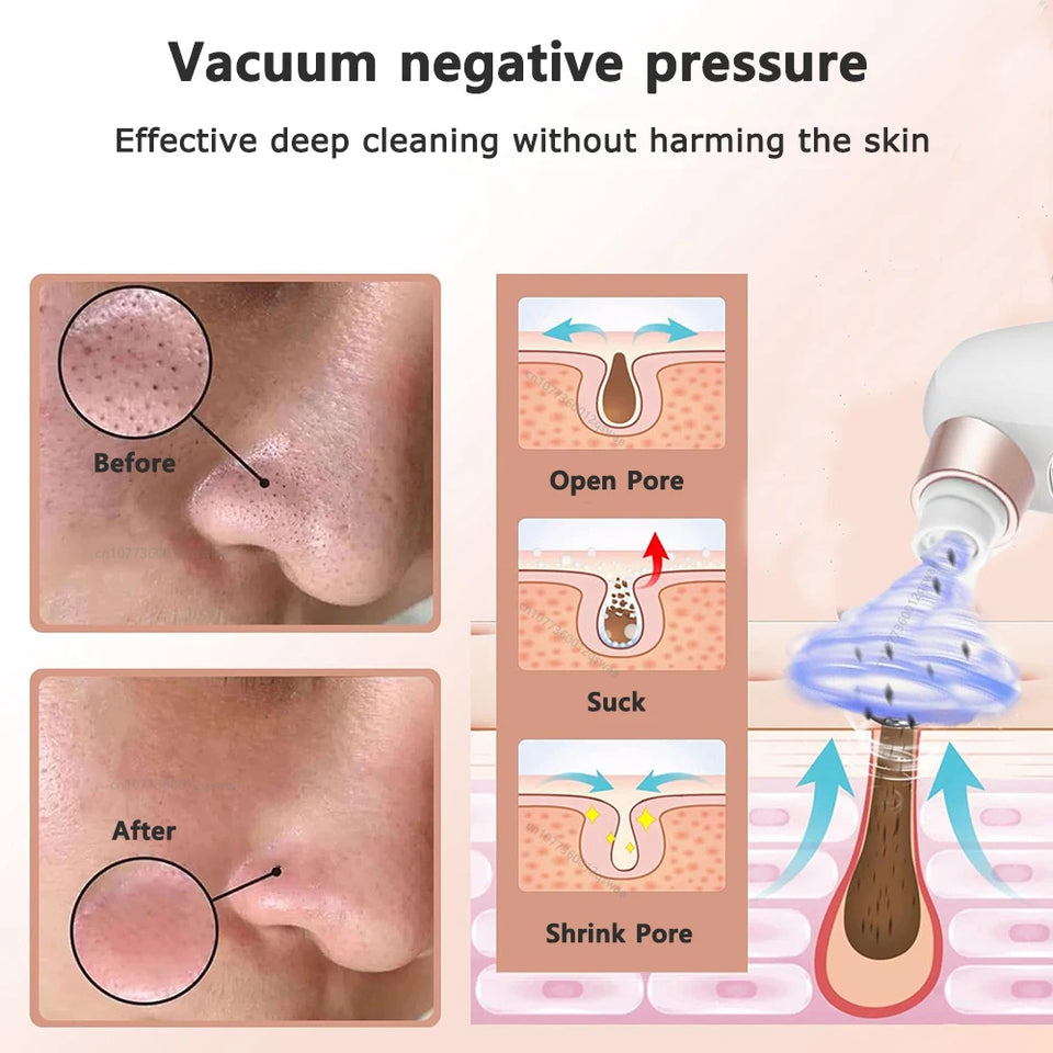 Blackhead Remover Pore Vacuum Face Cleaner